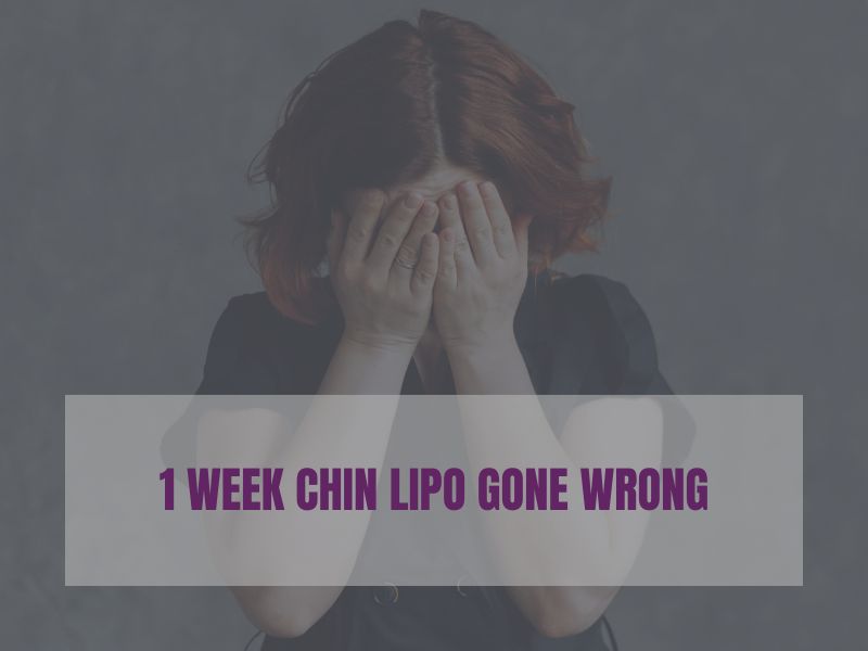 1 week chin lipo gone wrong