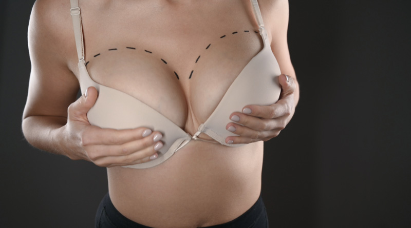 Breast Augmentation Blog