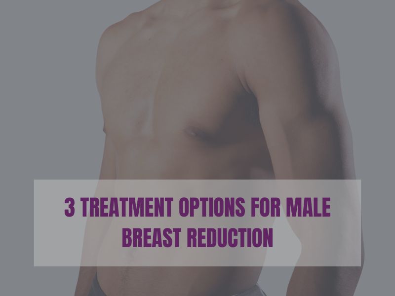 3 Treatment Options for Male Breast Reduction