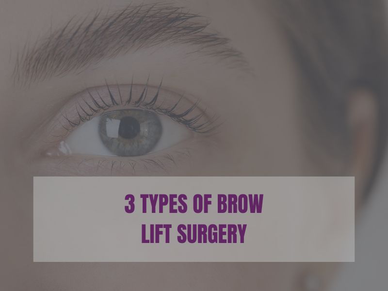 3 Types of Brow Lift Surgery