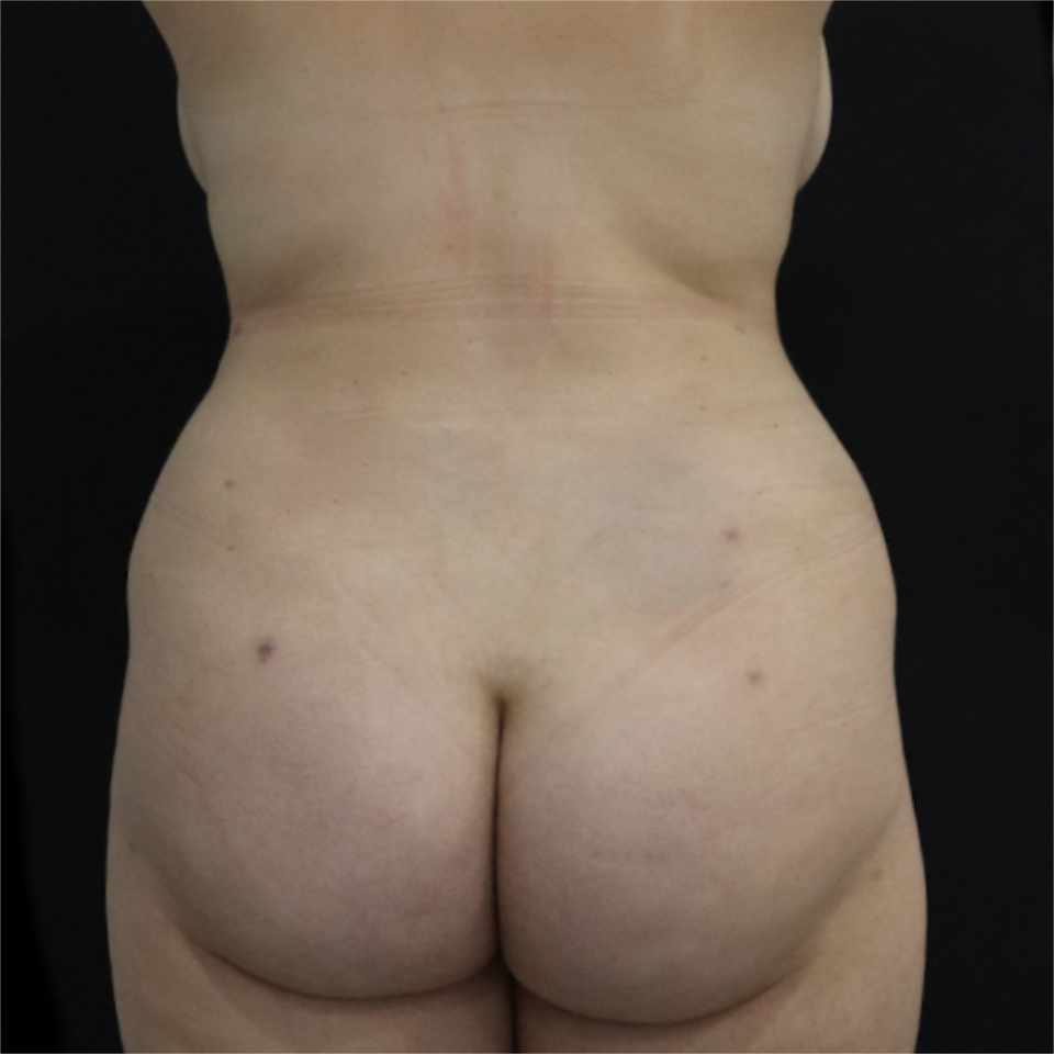 New Jersey BBL Back After