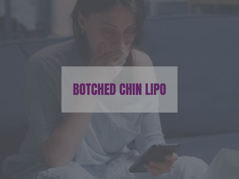 Botched chin lipo