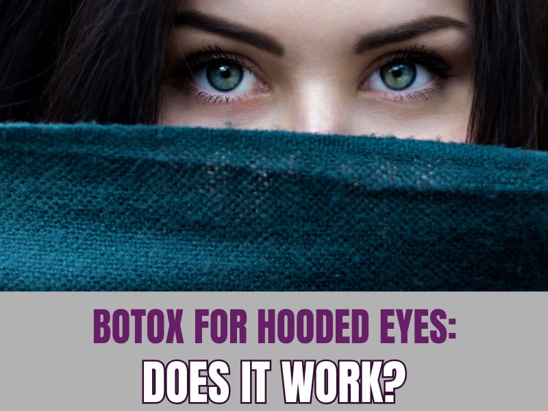Botox for Hooded Eyes Does It Work