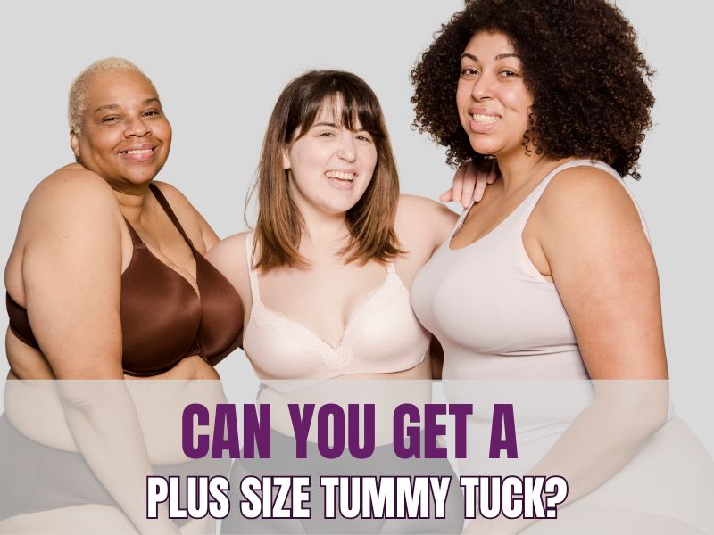 Can You Get a Plus Size Tummy Tuck
