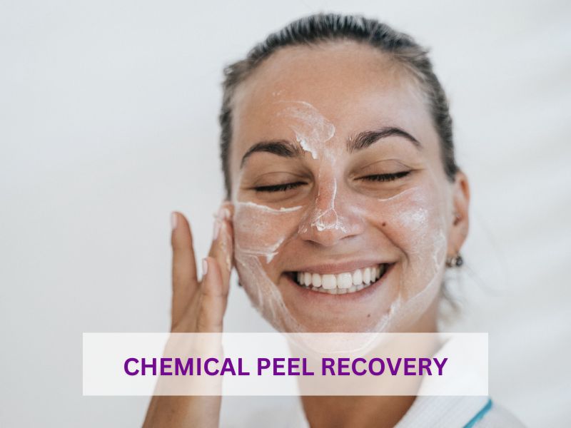 Chemical peel recovery Chemical peel recovery
