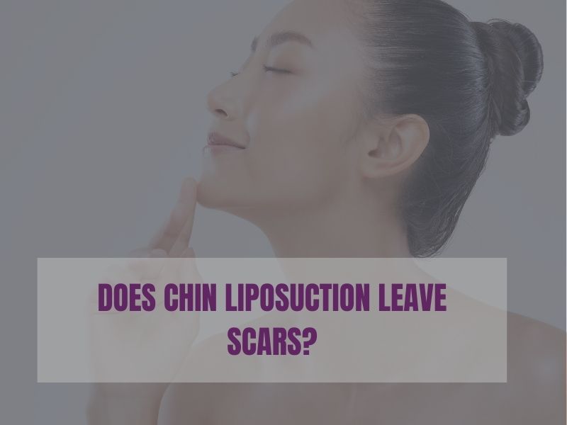 DOES CHIN LIPOSUCTION LEAVE SCARS