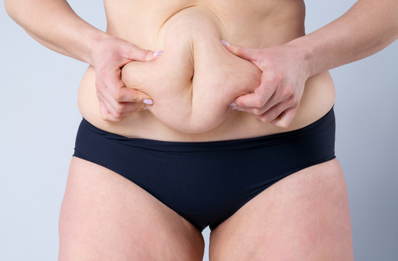 Different types of liposuction