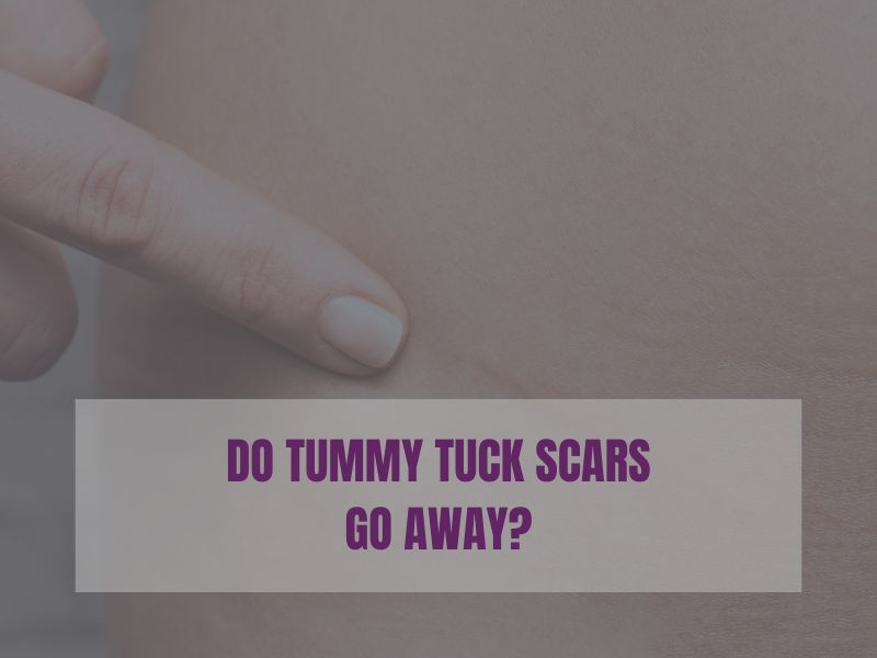 Do Tummy Tuck Scars Go Away