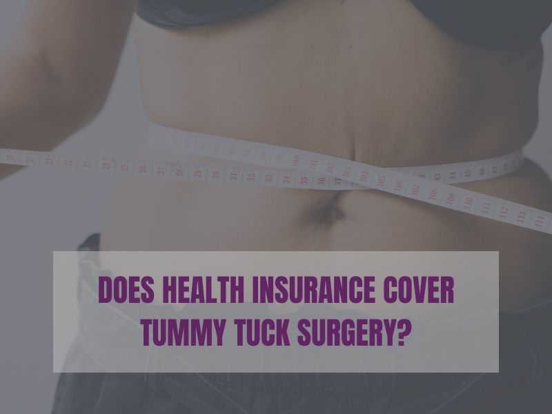 Does Health Insurance Cover Tummy Tuck Surgery