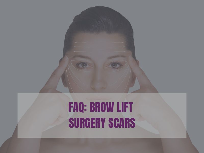 FAQ Brow Lift Surgery Scars