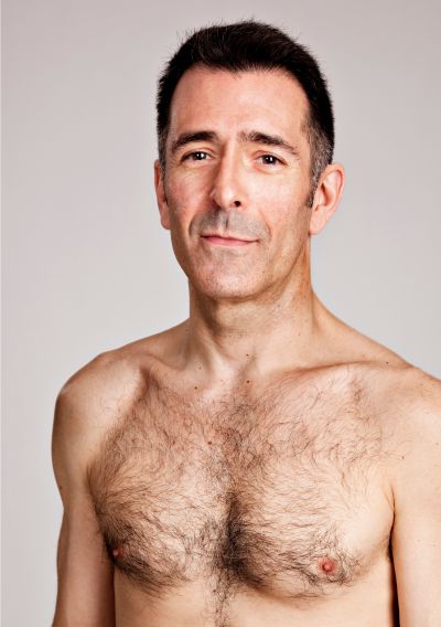 Gynecomastia Surgery Covered By Insurance