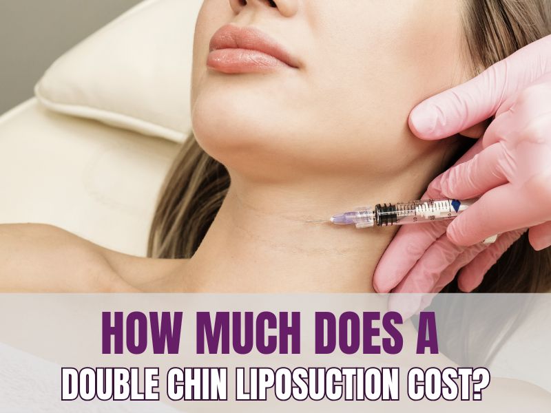 How Much Does a Double Chin Liposuction Cost