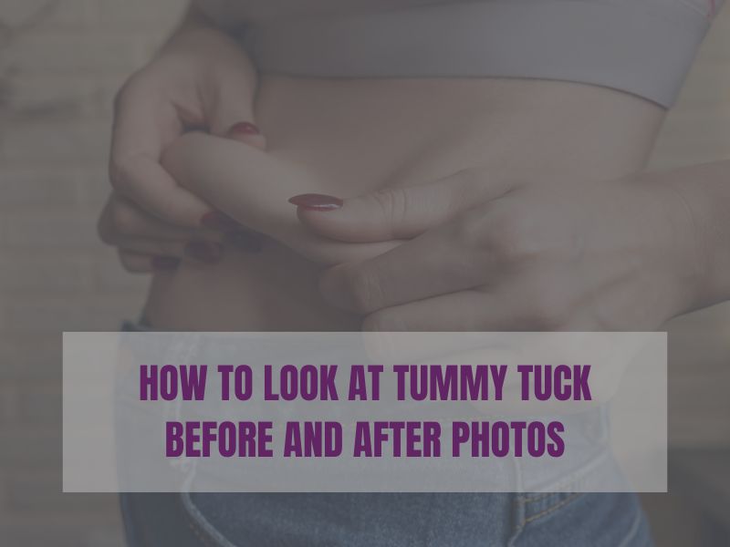 How to Look at Tummy Tuck Before and After Photos