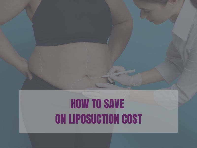 What Is An Otoplasty Headband