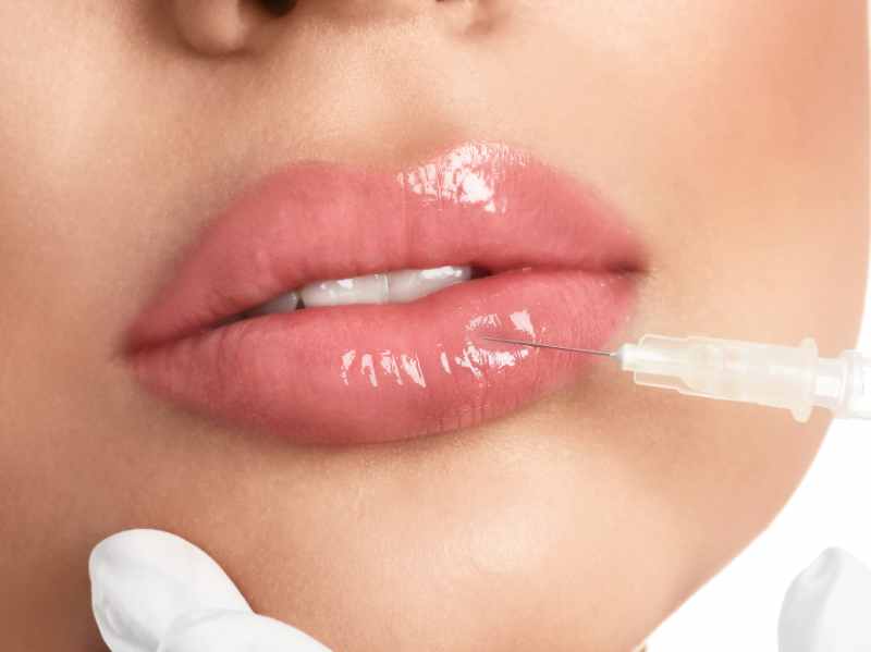 Lip Injection Aftercare Tips