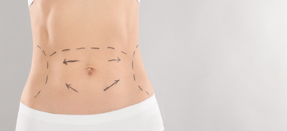 Liposuction Before And After