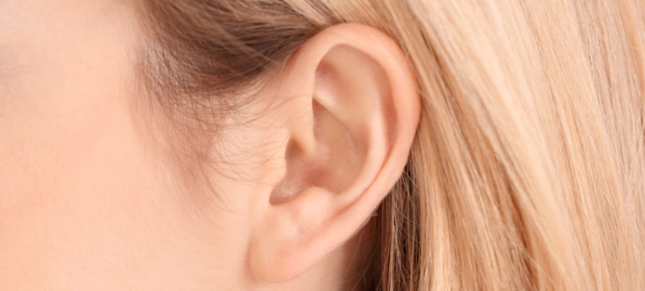 Otoplasty Scar
