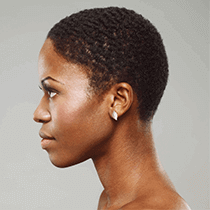 Revision Rhinoplasty Procedure