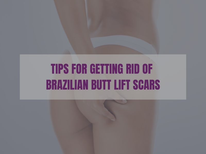 Tips for Getting Rid of Brazilian Butt Lift Scars