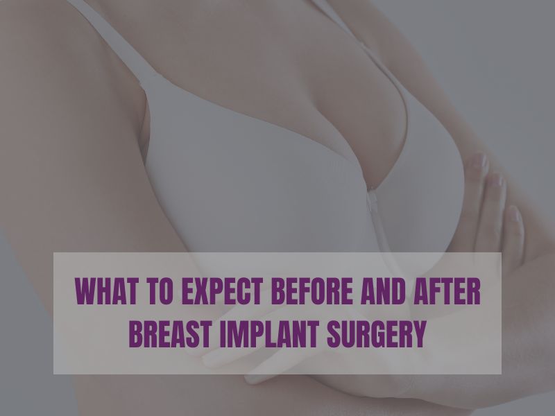 WHAT TO EXPECT BEFORE AND AFTER BREAST IMPLANT SURGERY