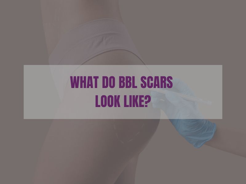 What Do BBL Scars Look Like
