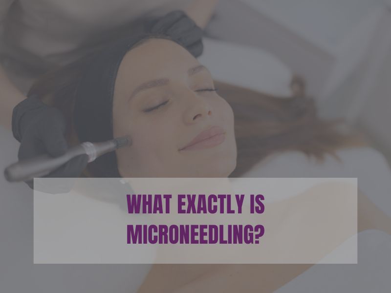 What Exactly Is Microneedling