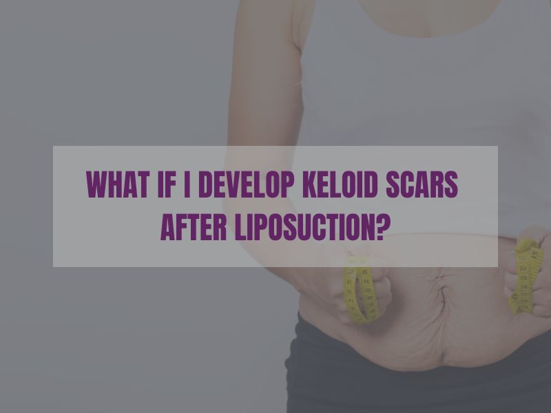 What if I Develop Keloid Scars After Liposuction