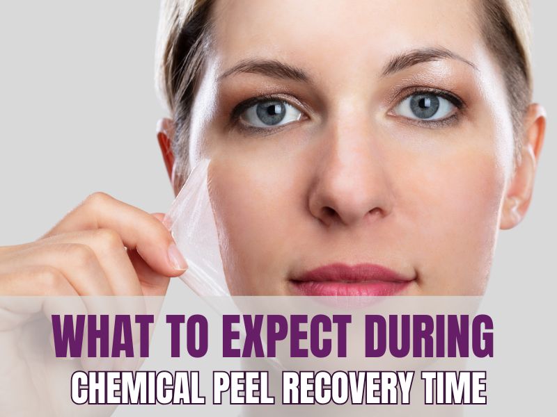 What to Expect During Chemical Peel Recovery Time What to Expect During Chemical Peel Recovery Time