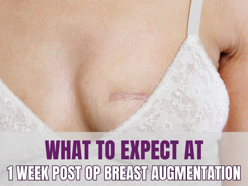 What to Expect at 1 Week Post Op Breast Augmentation