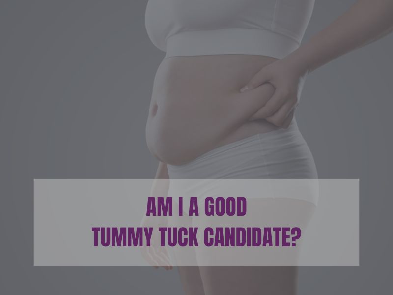 Candidate For Tummy Tuck am i a good (1)