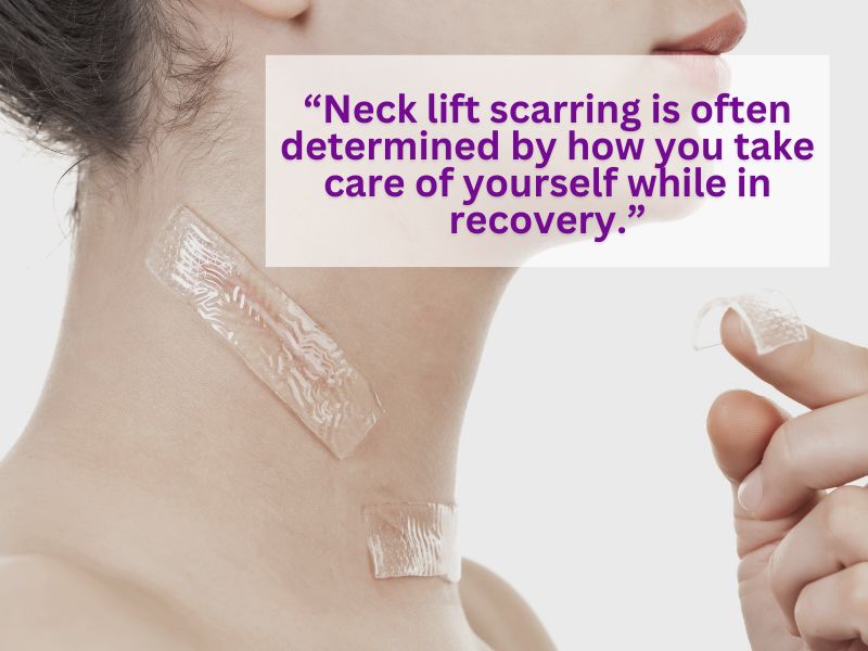 neck lift scars pictures neck lift scars pictures