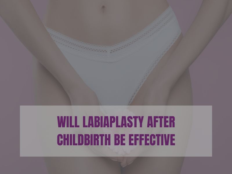 will labiaplasty after